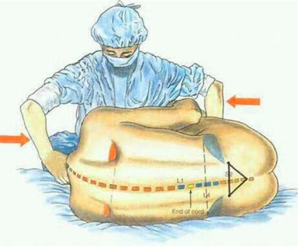 腰椎穿刺点定位解剖图