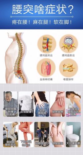 腰椎间盘突出的治疗方法的相关图片
